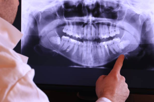 Best Emergency Dental Care for Trauma or Injury in Flanders, NJ